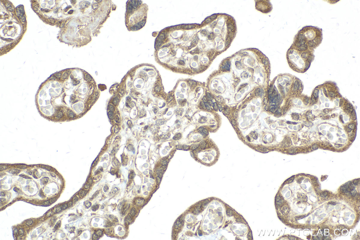 Immunohistochemistry (IHC) staining of human placenta tissue using RHOBTB3 Polyclonal antibody (13945-1-AP)