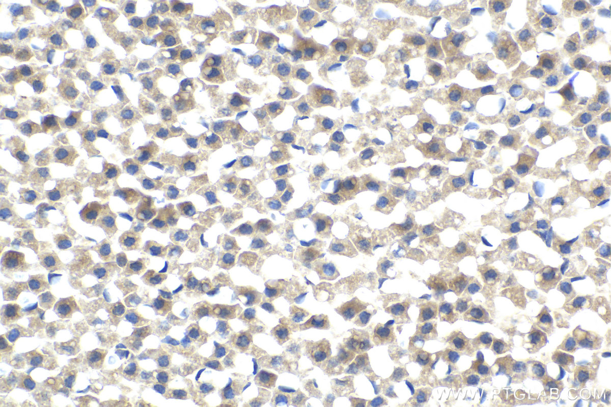 Immunohistochemistry (IHC) staining of rat adrenal gland tissue using RHOBTB3 Polyclonal antibody (13945-1-AP)