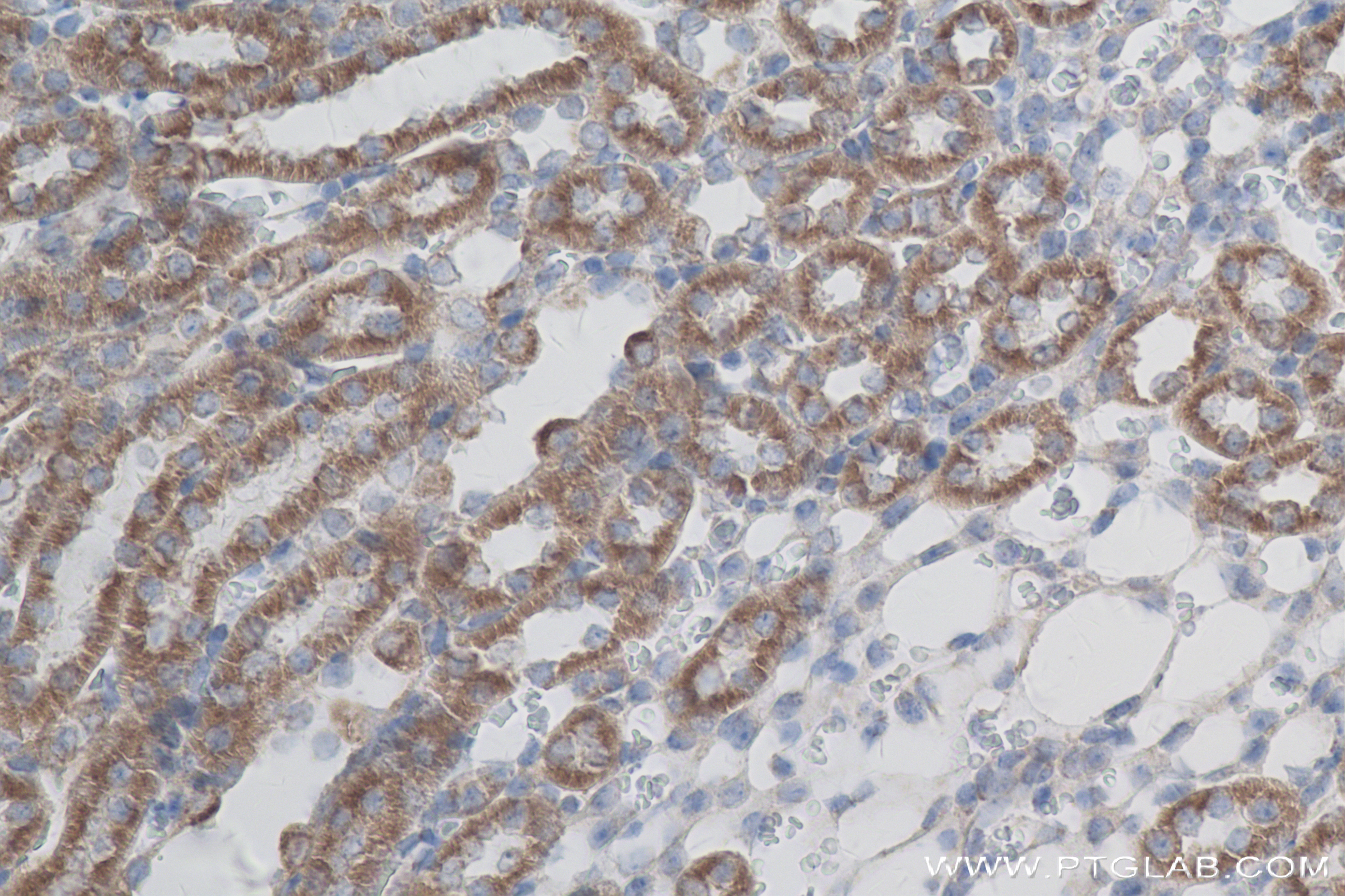 Immunohistochemistry (IHC) staining of mouse kidney tissue using MIRO1 Recombinant antibody (84055-5-RR)