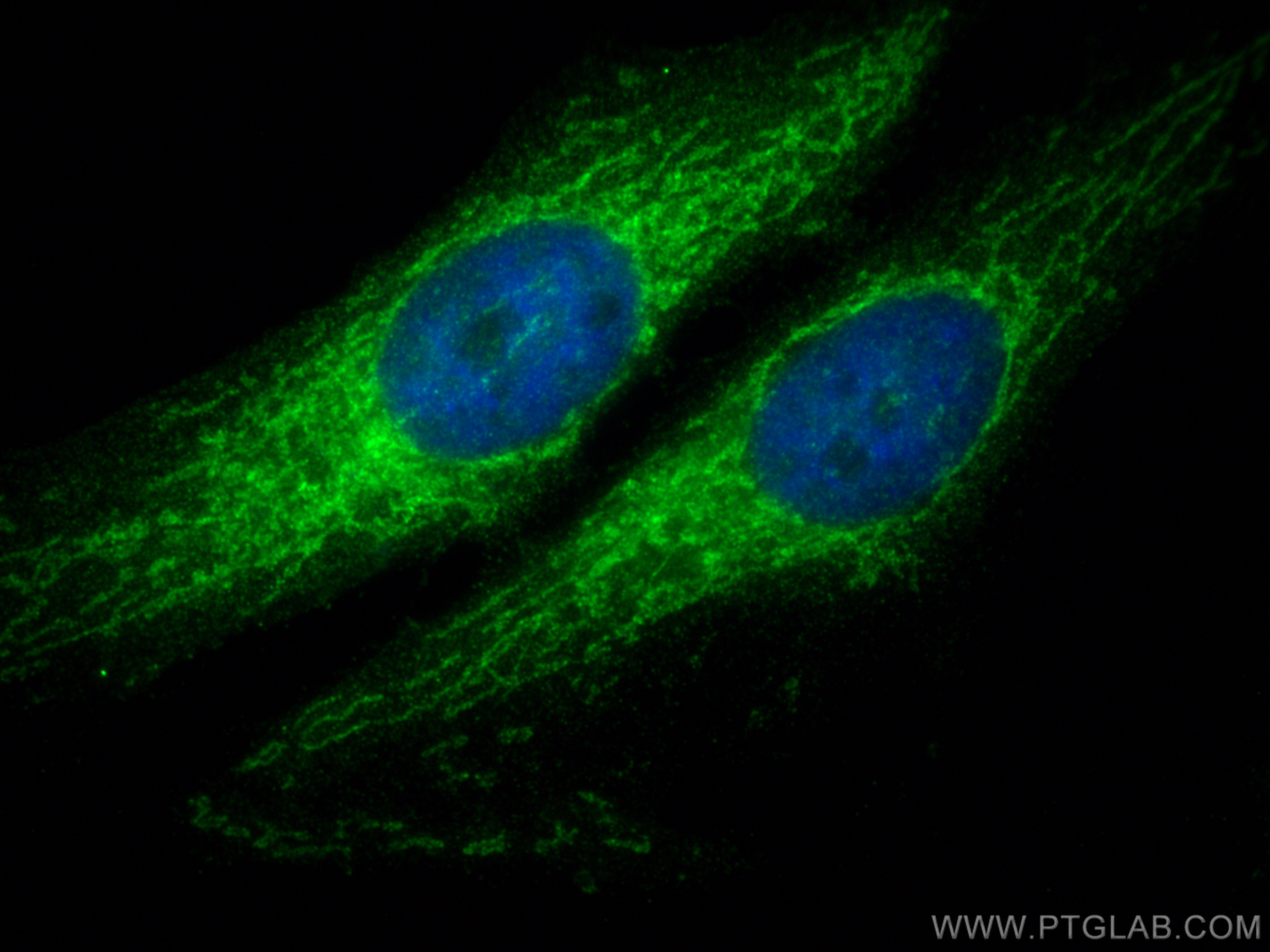 Immunofluorescence (IF) / fluorescent staining of HeLa cells using MIRO2 Polyclonal antibody (11237-1-AP)