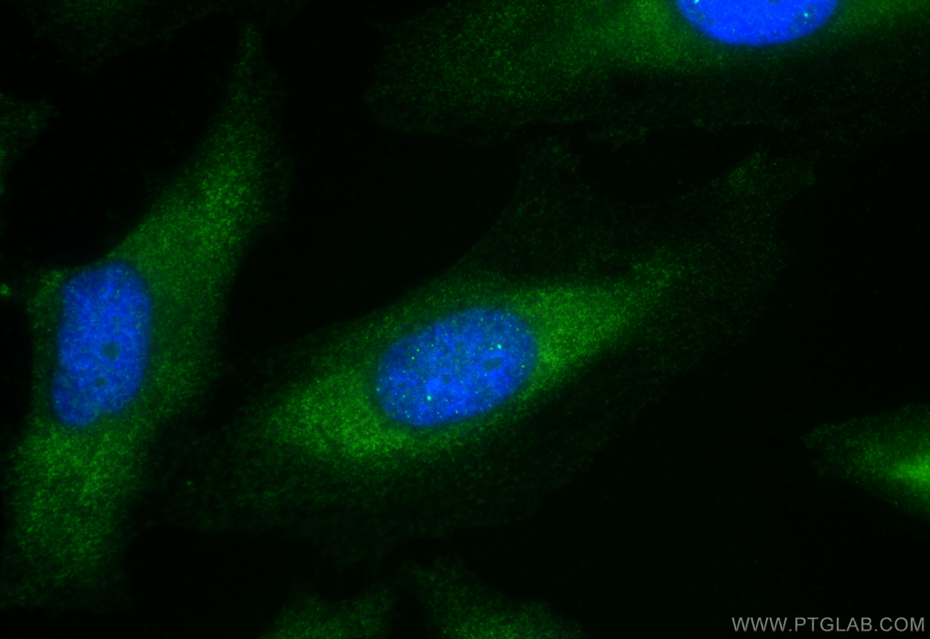 Immunofluorescence (IF) / fluorescent staining of HeLa cells using RIC8A Polyclonal antibody (18707-1-AP)