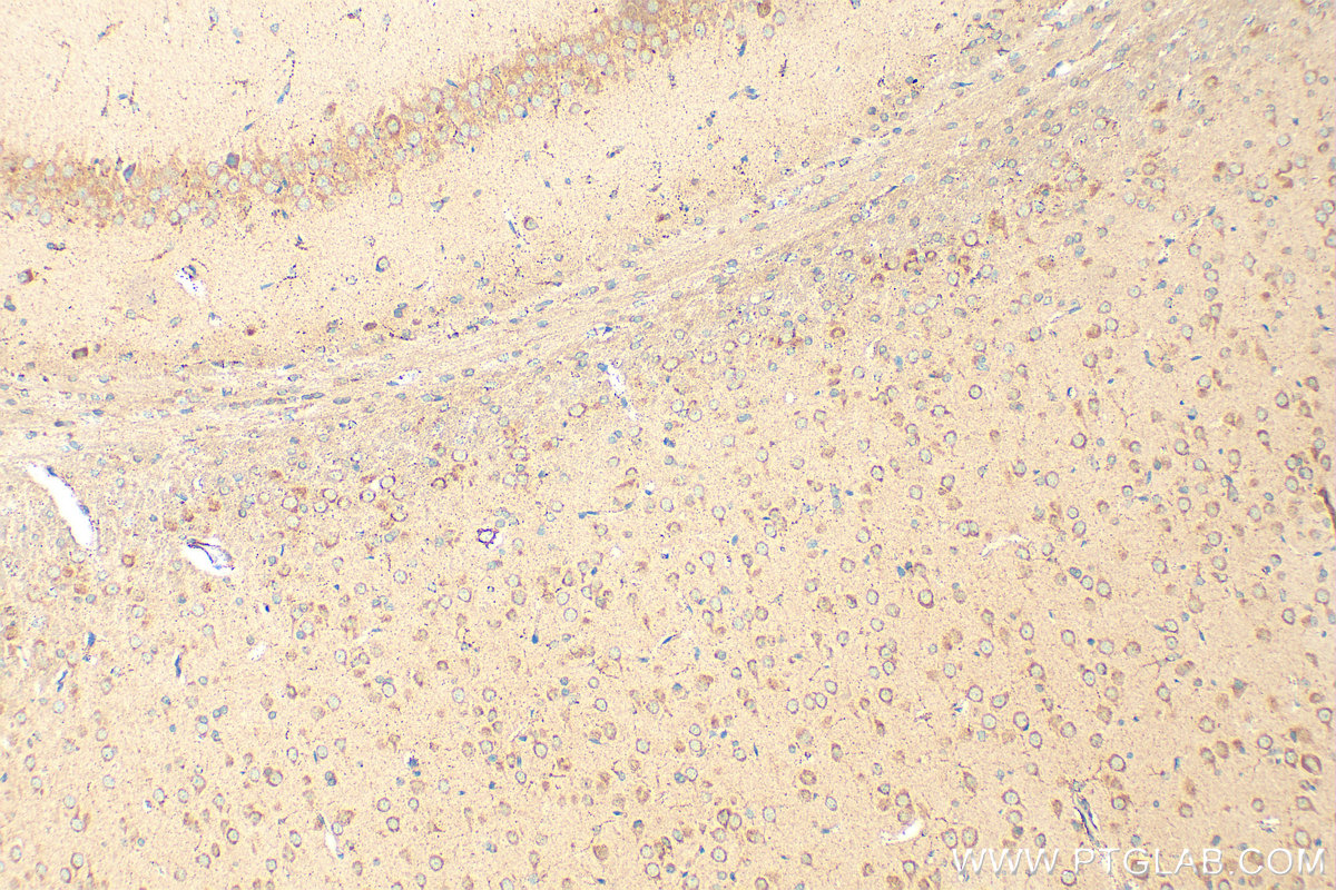 Immunohistochemistry (IHC) staining of rat brain tissue using RIC8A Polyclonal antibody (18707-1-AP)