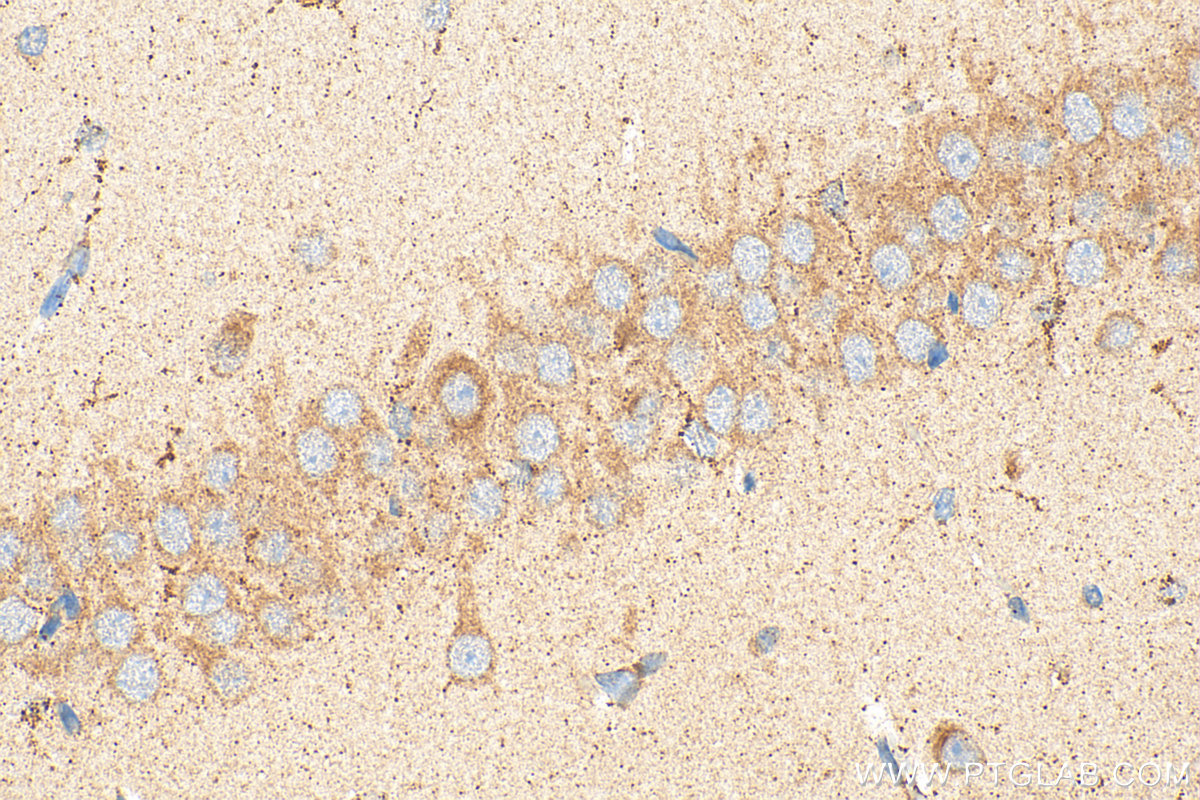 Immunohistochemistry (IHC) staining of rat brain tissue using RIC8A Polyclonal antibody (18707-1-AP)