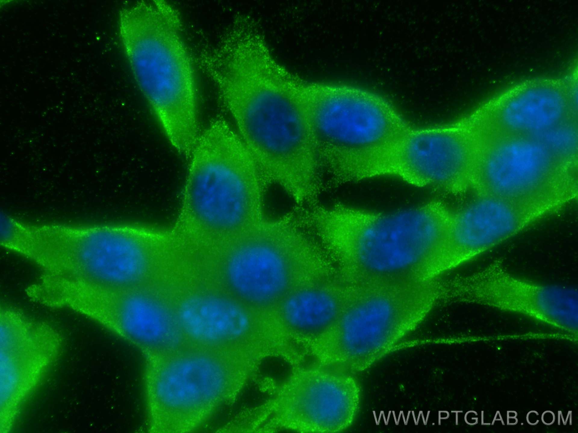 Immunofluorescence (IF) / fluorescent staining of NIH/3T3 cells using RICTOR Monoclonal antibody (66867-2-Ig)