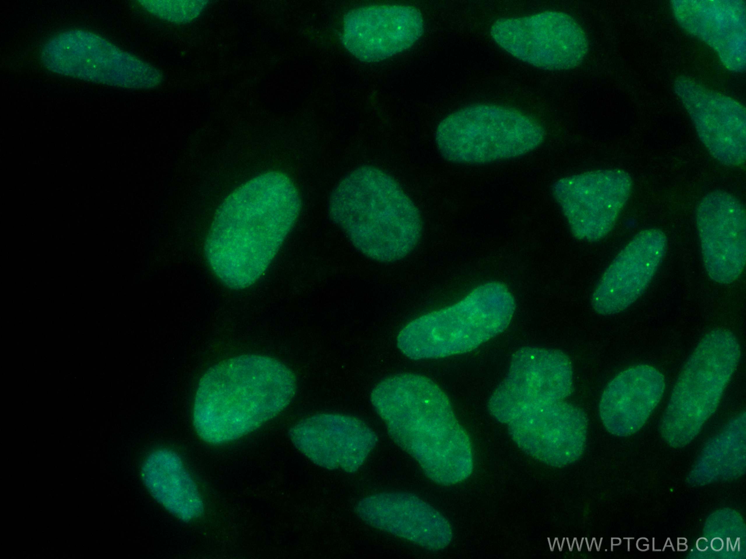 Immunofluorescence (IF) / fluorescent staining of HEK-293 cells using CoraLite® Plus 488-conjugated RIF1 Polyclonal anti (CL488-30119)