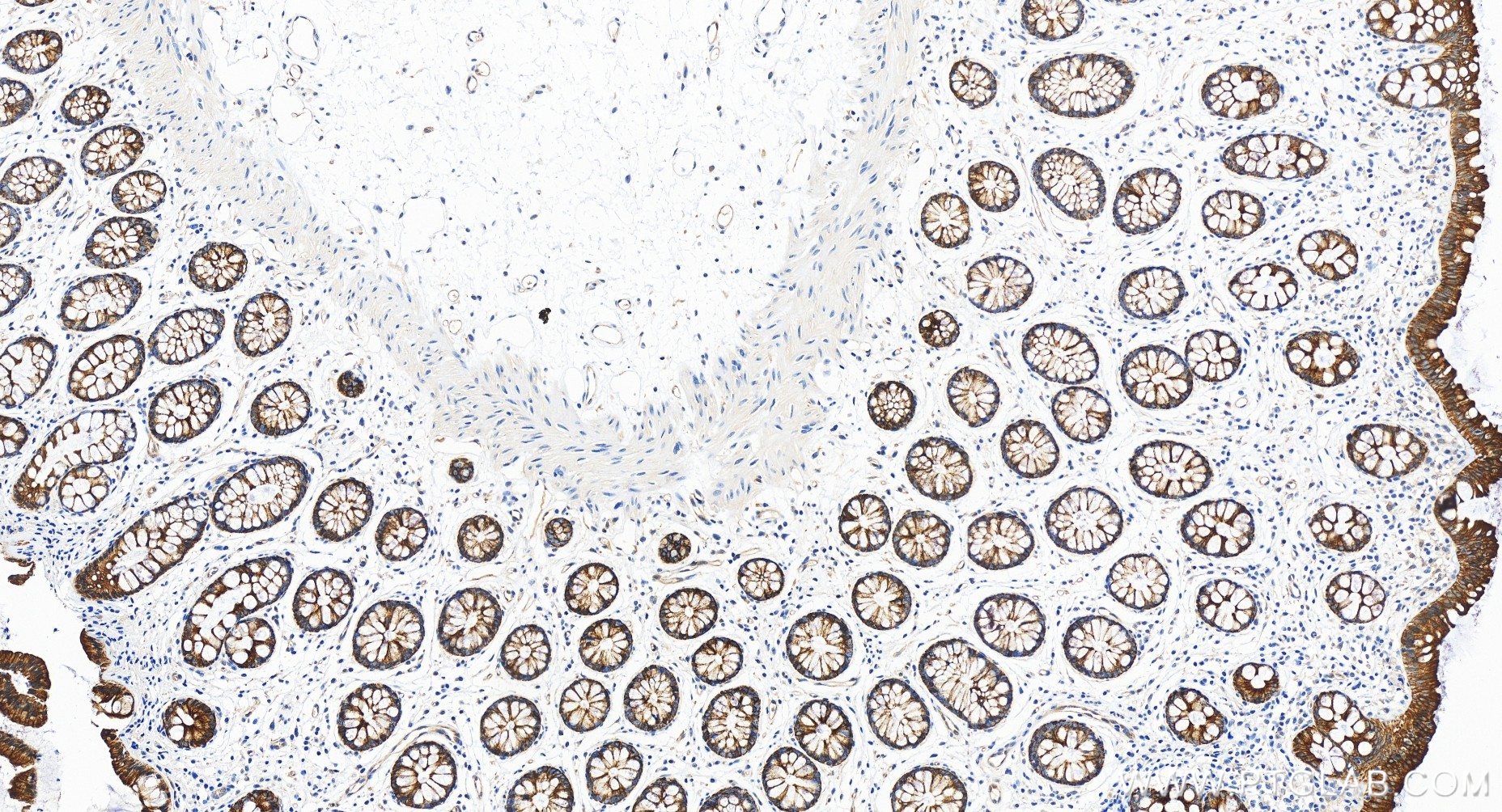 Immunohistochemistry (IHC) staining of human colon tissue using RIG-1/DDX58 Recombinant antibody (84861-5-RR)