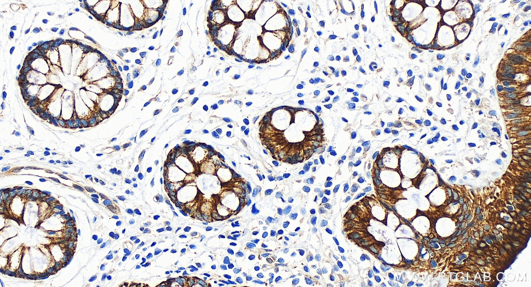Immunohistochemistry (IHC) staining of human colon tissue using RIG-1/DDX58 Recombinant antibody (84861-5-RR)