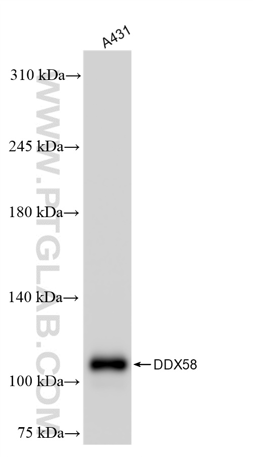 Western Blot (WB) analysis of A431 cells using RIG-1/DDX58 Recombinant antibody (84861-5-RR)