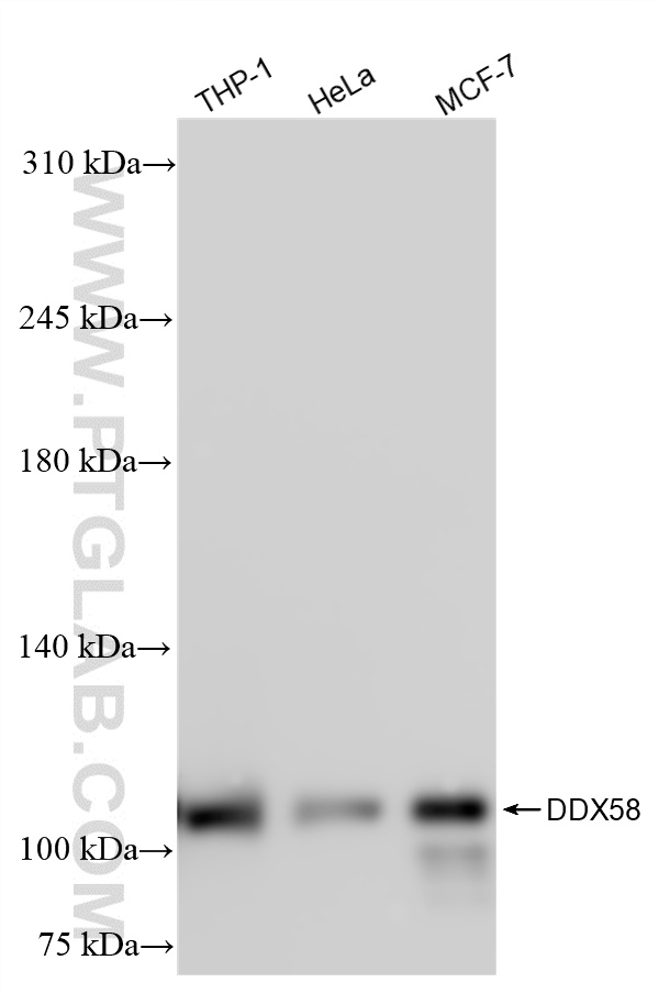 Western Blot (WB) analysis of various lysates using RIG-1/DDX58 Recombinant antibody (84861-5-RR)