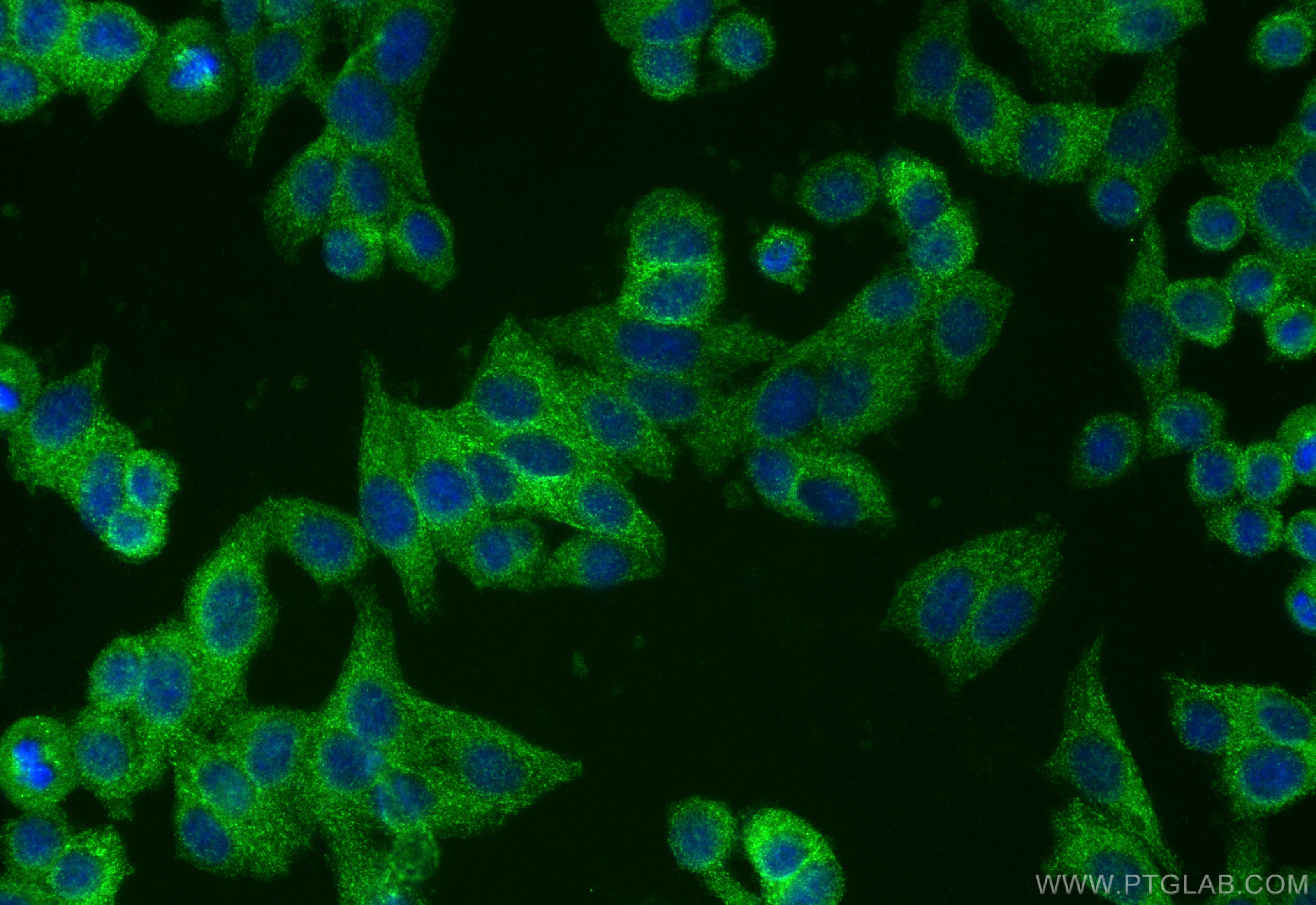 Immunofluorescence (IF) / fluorescent staining of HepG2 cells using RILP Polyclonal antibody (13574-1-AP)