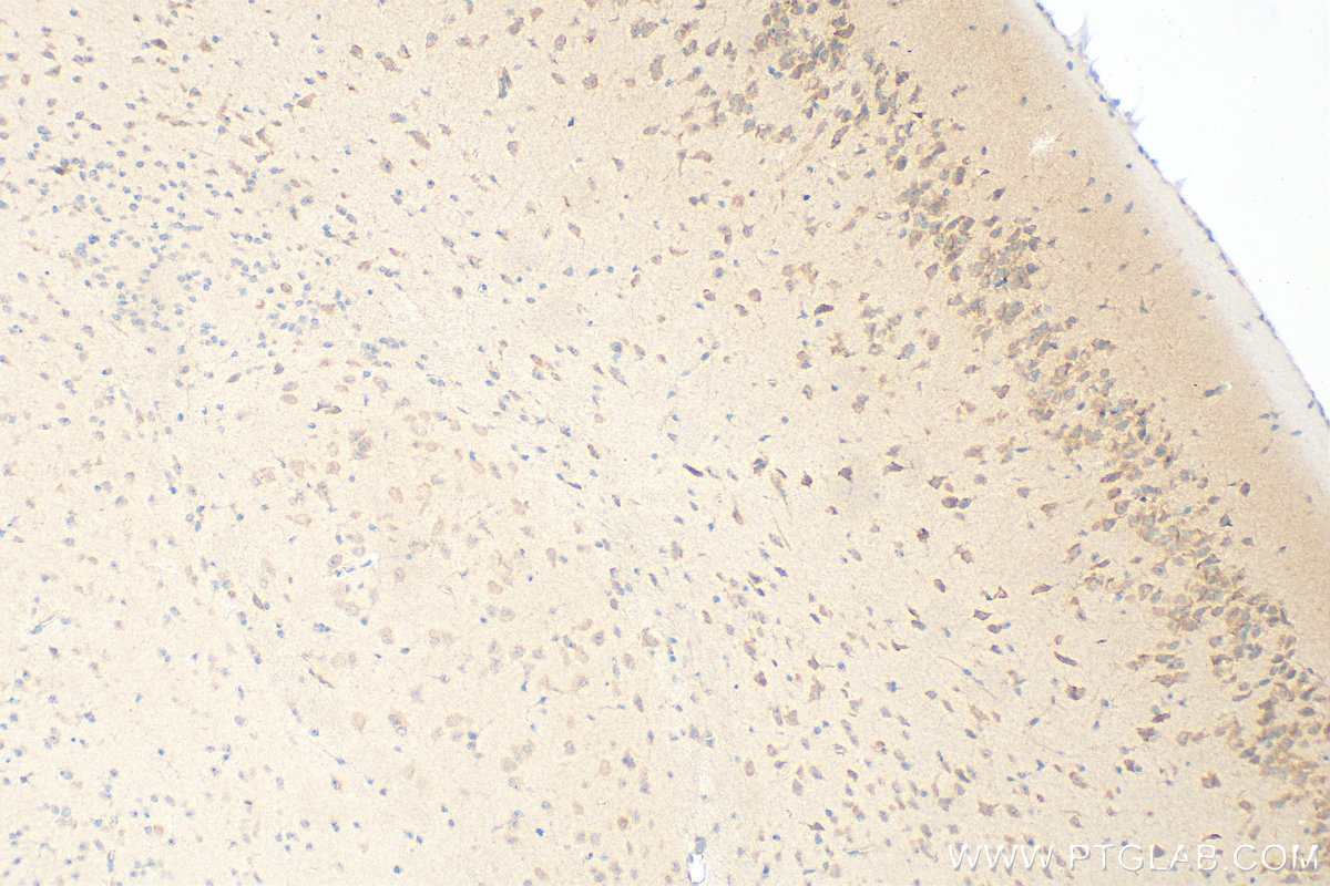 Immunohistochemistry (IHC) staining of mouse brain tissue using RILP Polyclonal antibody (13574-1-AP)