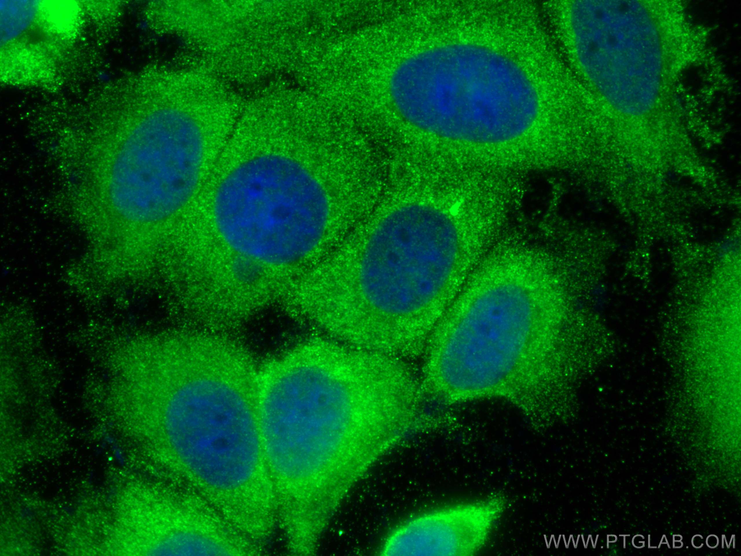 Immunofluorescence (IF) / fluorescent staining of MCF-7 cells using RIOK3 Polyclonal antibody (13593-1-AP)