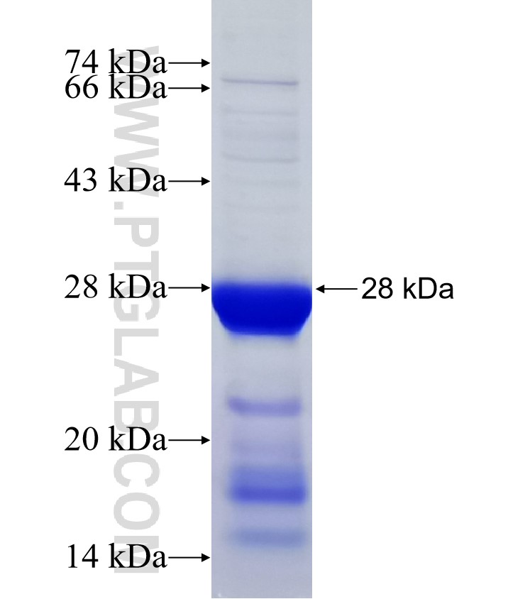 RIPK1 fusion protein Ag31943 SDS-PAGE