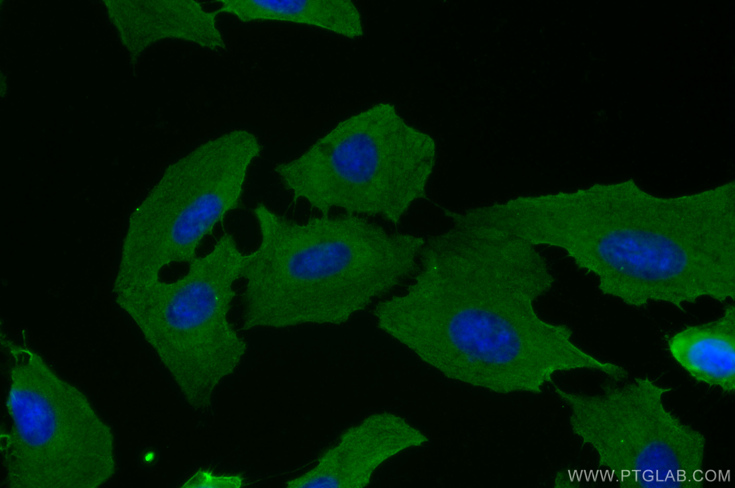 Immunofluorescence (IF) / fluorescent staining of U2OS cells using Phospho-RIPK1 (Ser161)  Monoclonal antibody (66854-1-Ig)