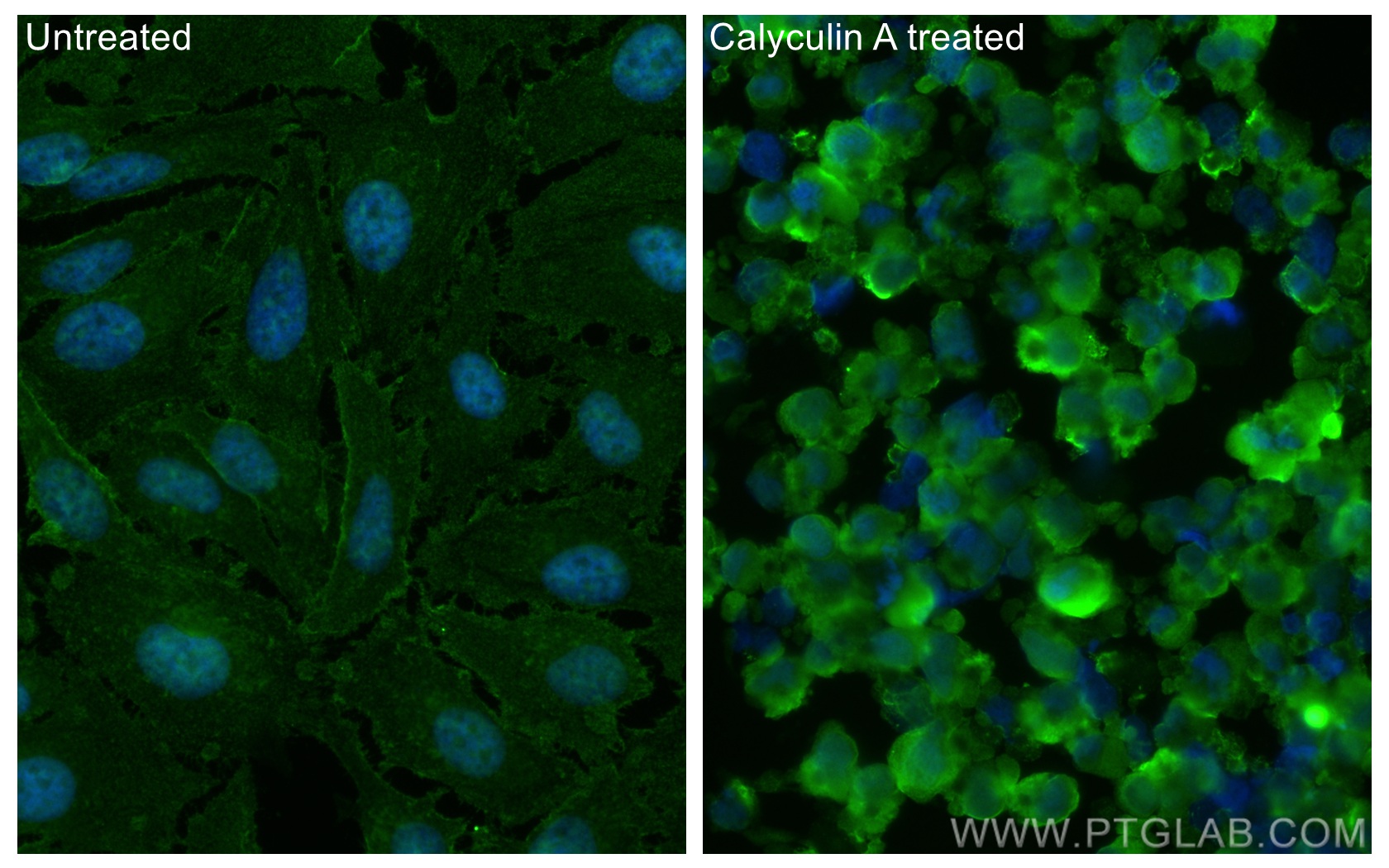 Immunofluorescence (IF) / fluorescent staining of HeLa cells using Phospho-RIPK1 (Ser161)  Monoclonal antibody (66854-1-Ig)