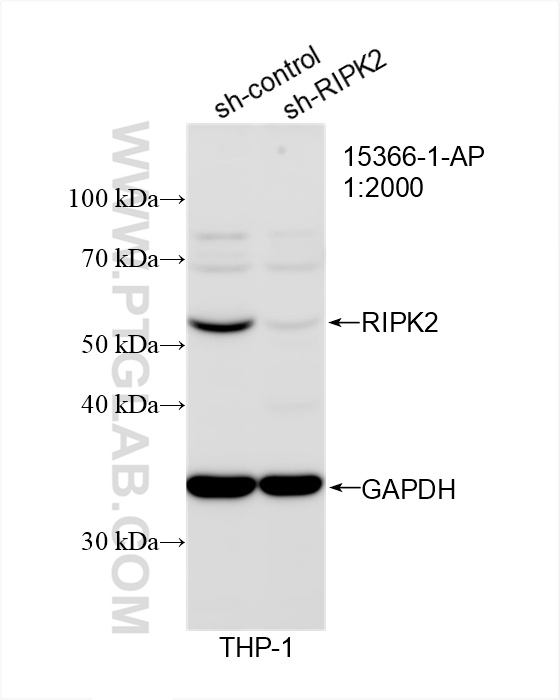 Western Blot (WB) analysis of THP-1 cells using RIPK2 Polyclonal antibody (15366-1-AP)