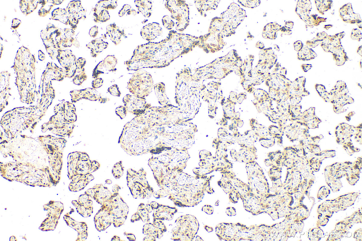 Immunohistochemistry (IHC) staining of human placenta tissue using RIP3 Polyclonal antibody (17563-1-AP)