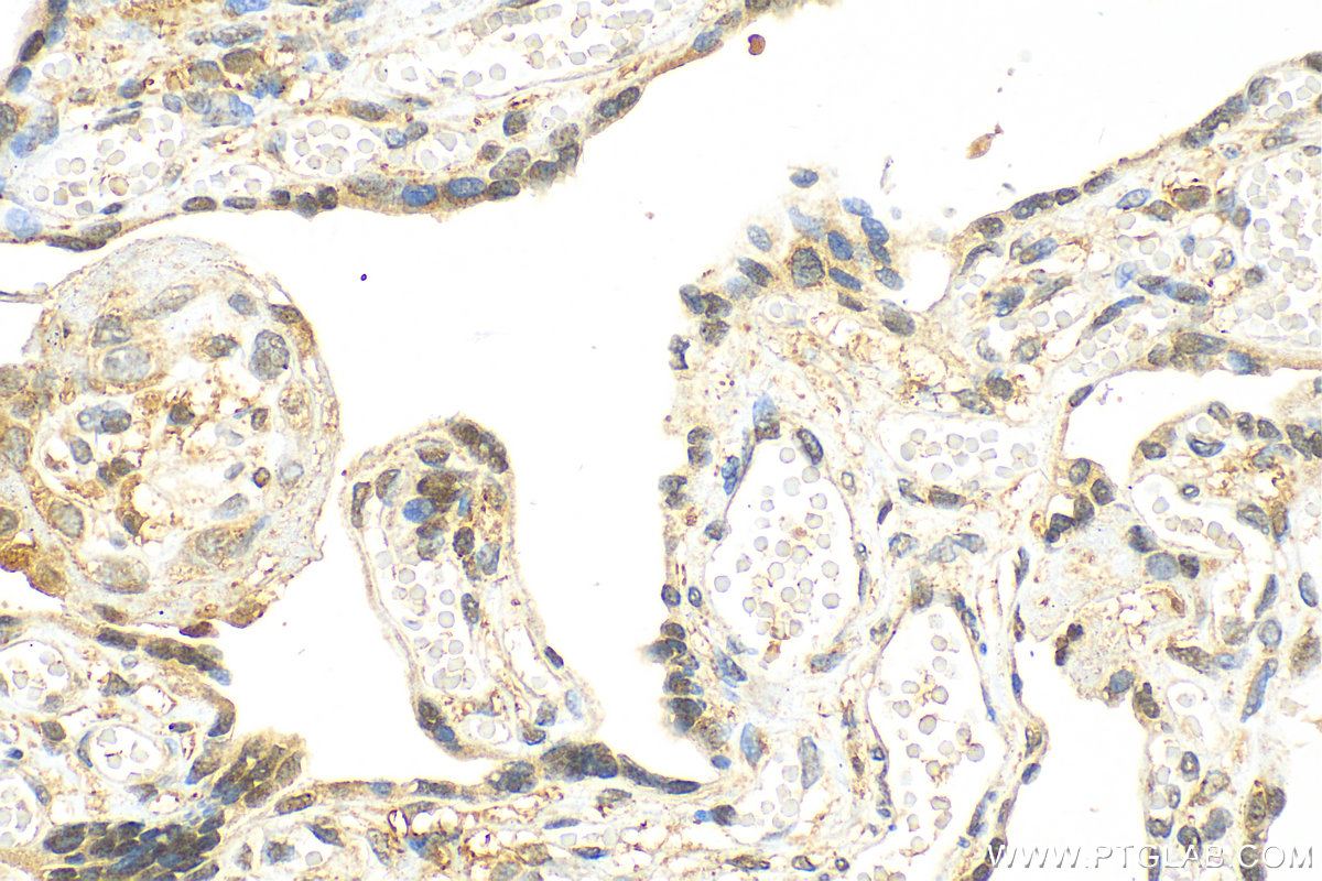 Immunohistochemistry (IHC) staining of human placenta tissue using RIP3 Polyclonal antibody (17563-1-AP)