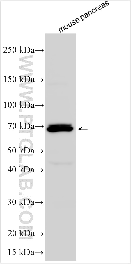 Western Blot (WB) analysis of various lysates using RIP3 Polyclonal antibody (17563-1-AP)