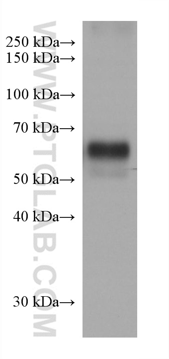 Western Blot (WB) analysis of SK-BR-3 cells using RIPK3 Monoclonal antibody (68786-2-Ig)