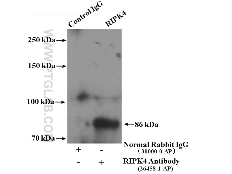 Immunoprecipitation (IP) experiment of SKOV-3 cells using RIPK4 Polyclonal antibody (26458-1-AP)