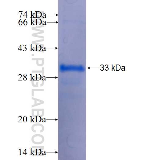 RIPK4 fusion protein Ag24202 SDS-PAGE