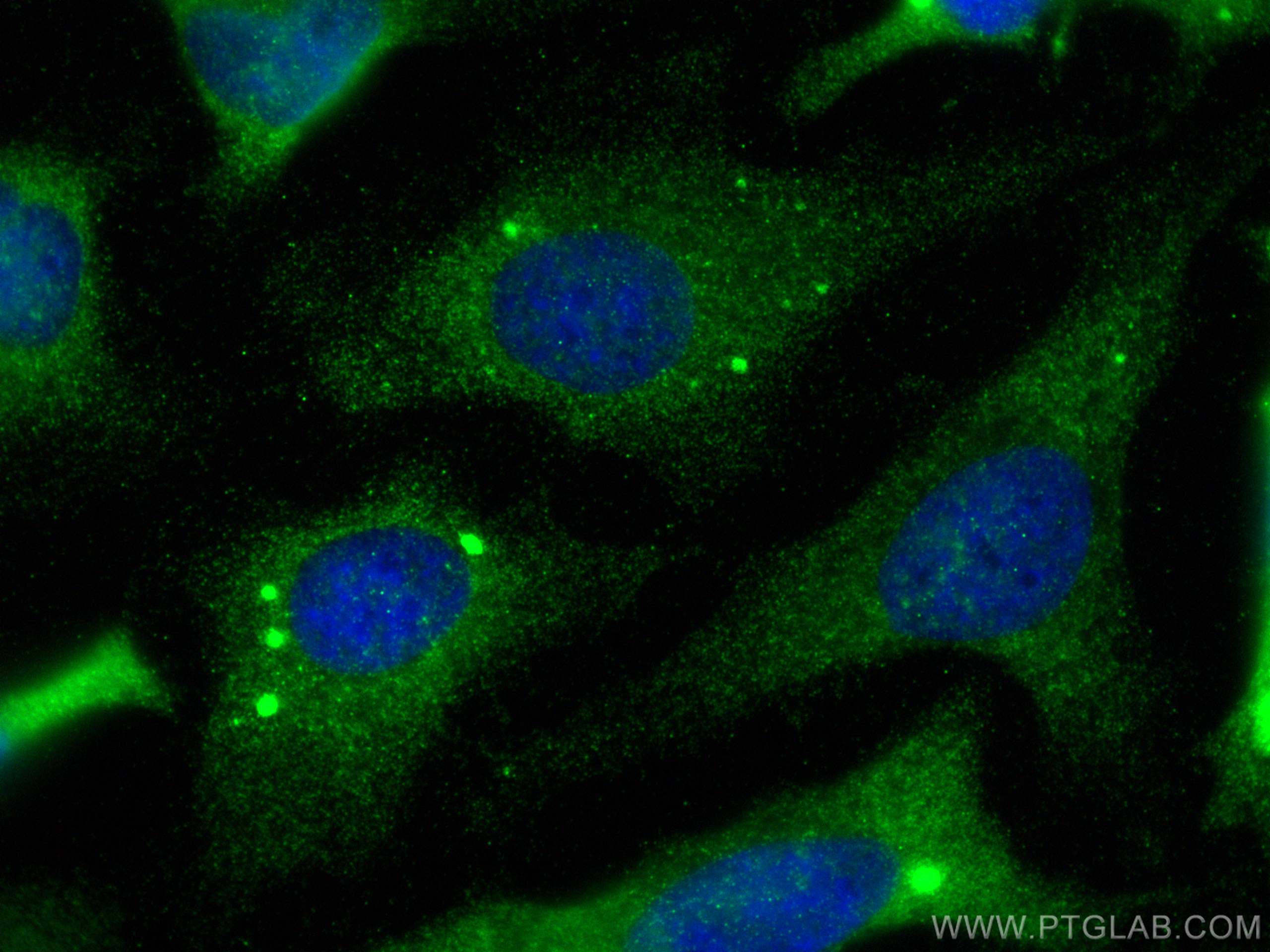 Immunofluorescence (IF) / fluorescent staining of HeLa cells using RLBP1 Polyclonal antibody (15356-1-AP)