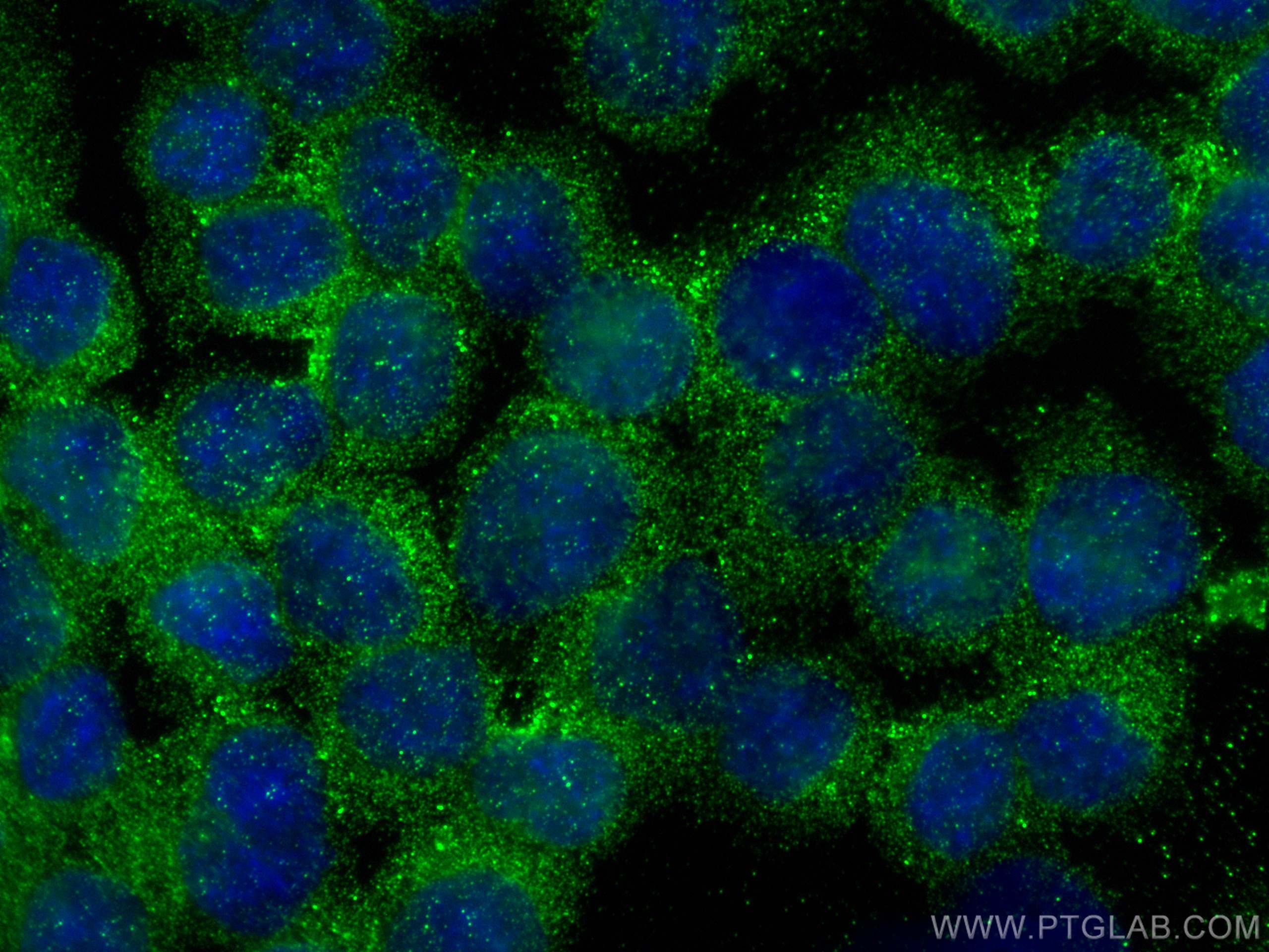 Immunofluorescence (IF) / fluorescent staining of Y79 cells using RLBP1 Polyclonal antibody (15356-1-AP)