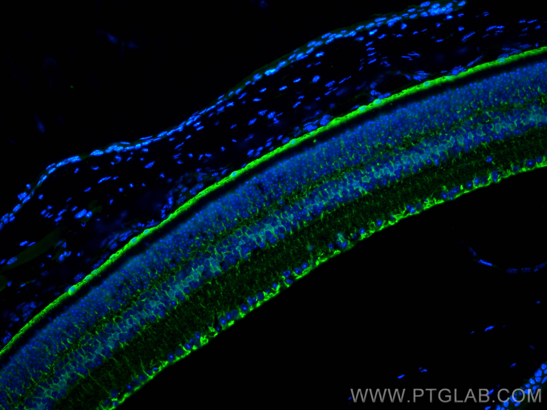 Immunofluorescence (IF) / fluorescent staining of mouse eye tissue using RLBP1 Polyclonal antibody (15356-1-AP)