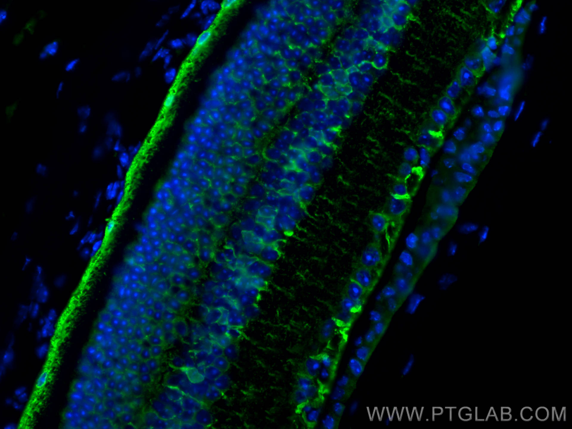 Immunofluorescence (IF) / fluorescent staining of mouse eye tissue using RLBP1 Polyclonal antibody (15356-1-AP)
