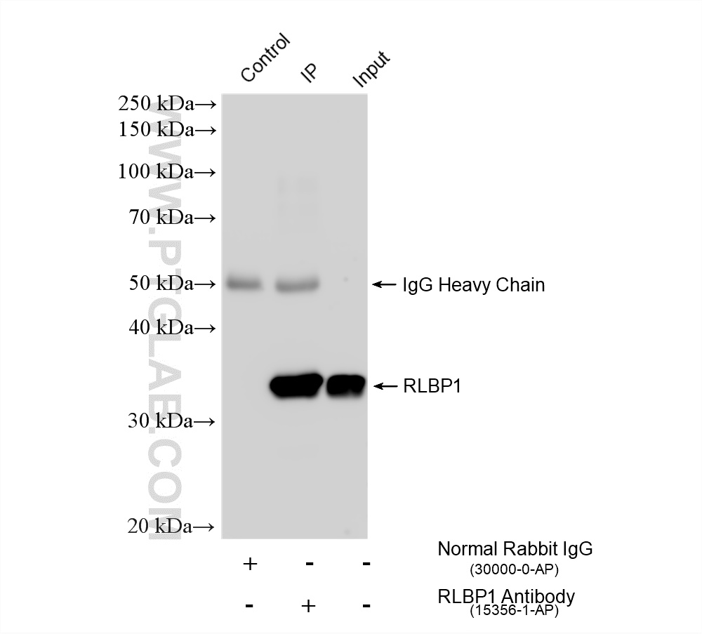 Immunoprecipitation (IP) experiment of mouse eye tissue using RLBP1 Polyclonal antibody (15356-1-AP)
