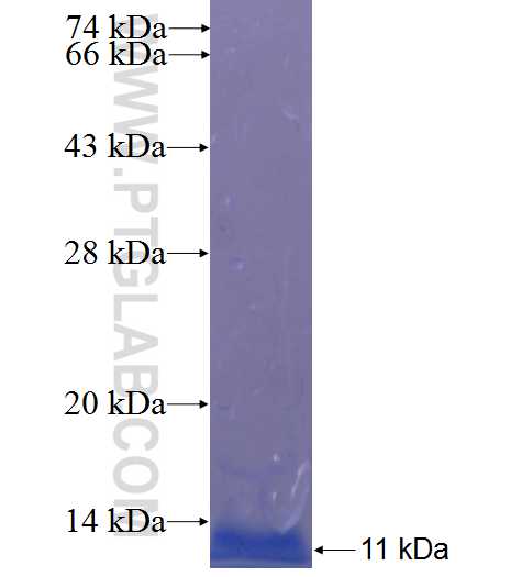 RMND5B fusion protein Ag22856 SDS-PAGE