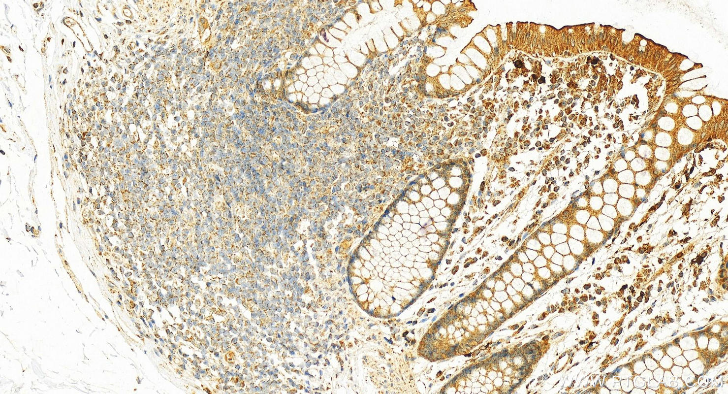 Immunohistochemistry (IHC) staining of human colon tissue using RNASE2/EDN Polyclonal antibody (18172-1-AP)