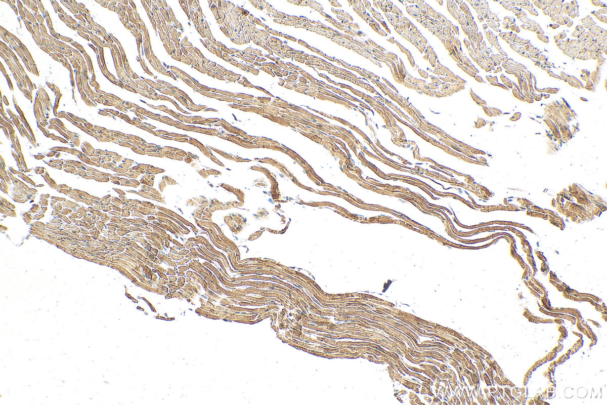 RNASE6