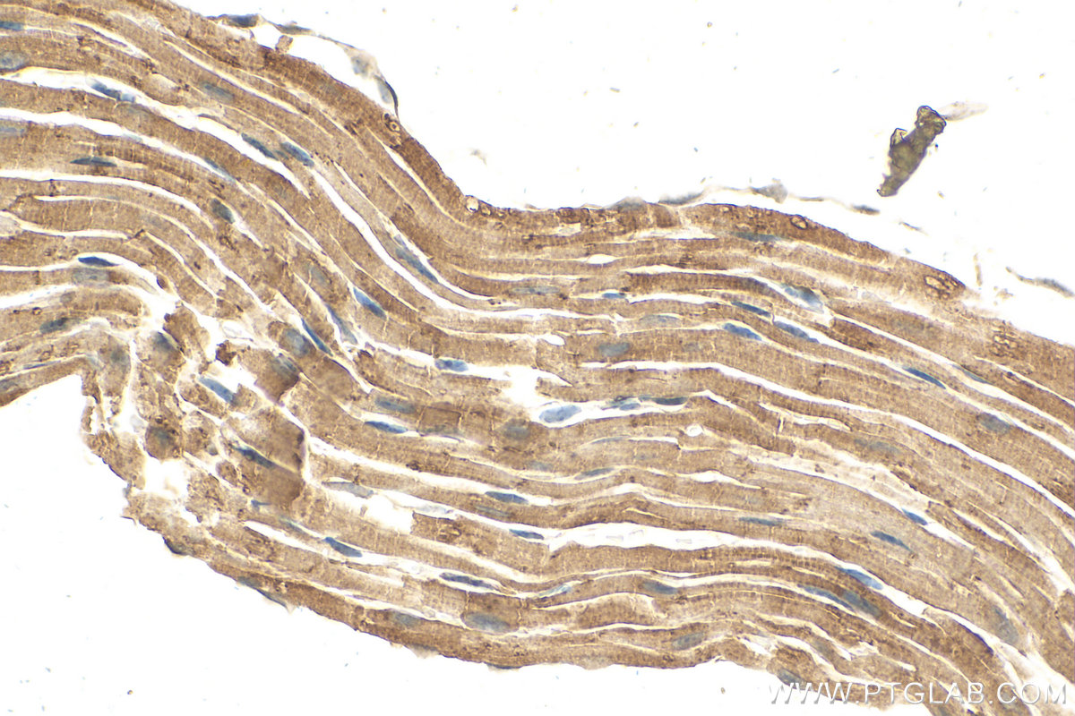 Immunohistochemistry (IHC) staining of mouse heart tissue using RNASE6 Polyclonal antibody (16425-1-AP)