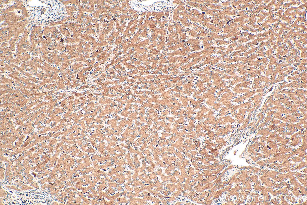 Immunohistochemistry (IHC) staining of human liver tissue using RNASE6 Polyclonal antibody (16425-1-AP)