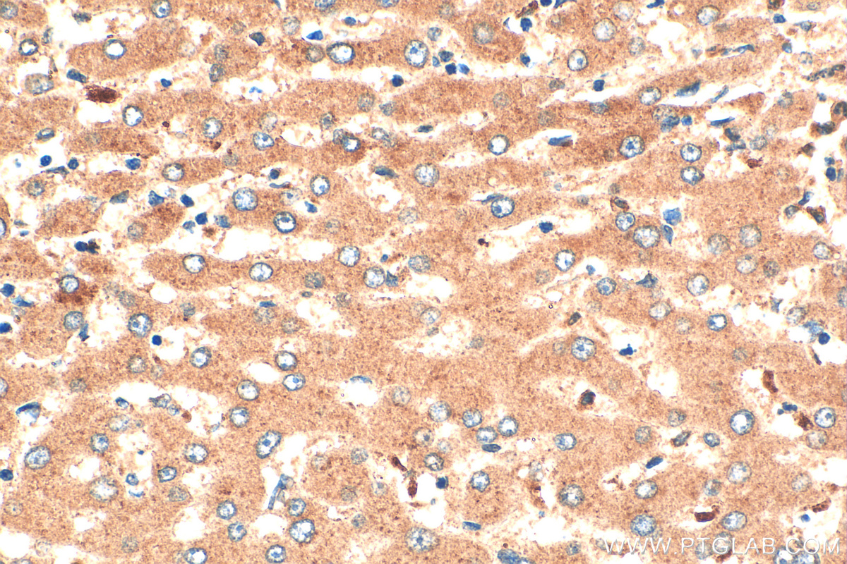 Immunohistochemistry (IHC) staining of human liver tissue using RNASE6 Polyclonal antibody (16425-1-AP)