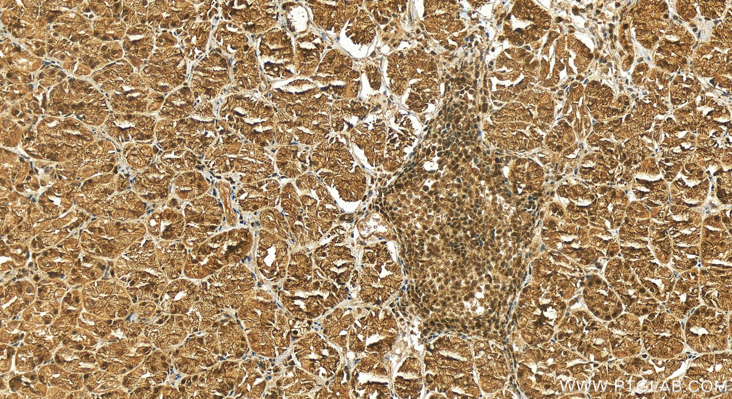 Immunohistochemistry (IHC) staining of human stomach tissue using RNASEH2A Polyclonal antibody (16132-1-AP)