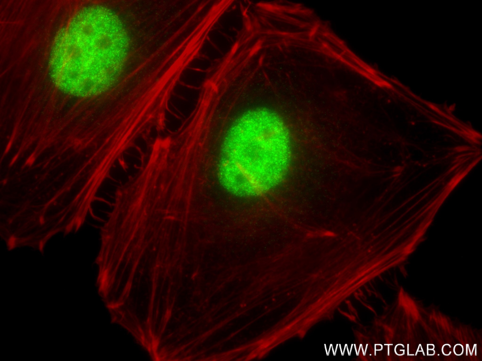 Immunofluorescence (IF) / fluorescent staining of HeLa cells using RNASEH2B Recombinant antibody (84097-6-RR)