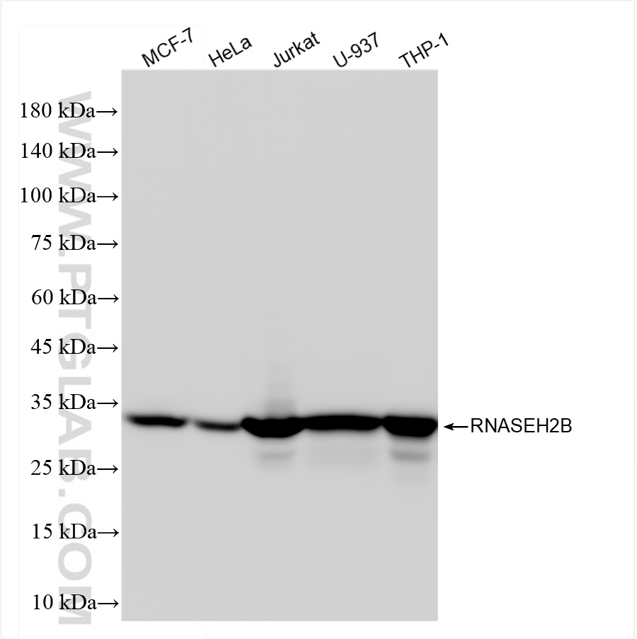 Western Blot (WB) analysis of various lysates using RNASEH2B Recombinant antibody (84097-6-RR)