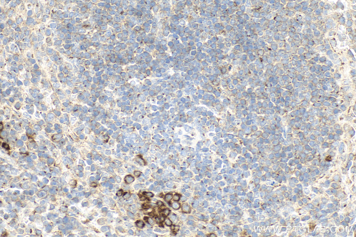 Immunohistochemistry (IHC) staining of mouse spleen tissue using RNASET2 Polyclonal antibody (13753-1-AP)