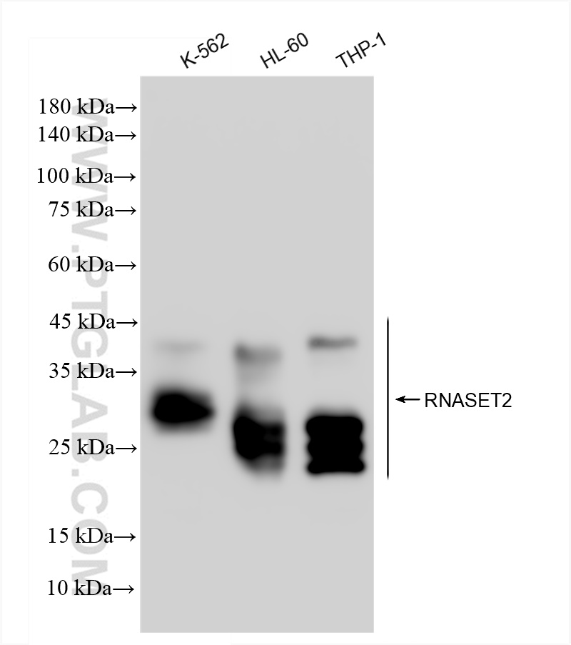 Western Blot (WB) analysis of various lysates using RNASET2 Recombinant antibody (83650-1-RR)