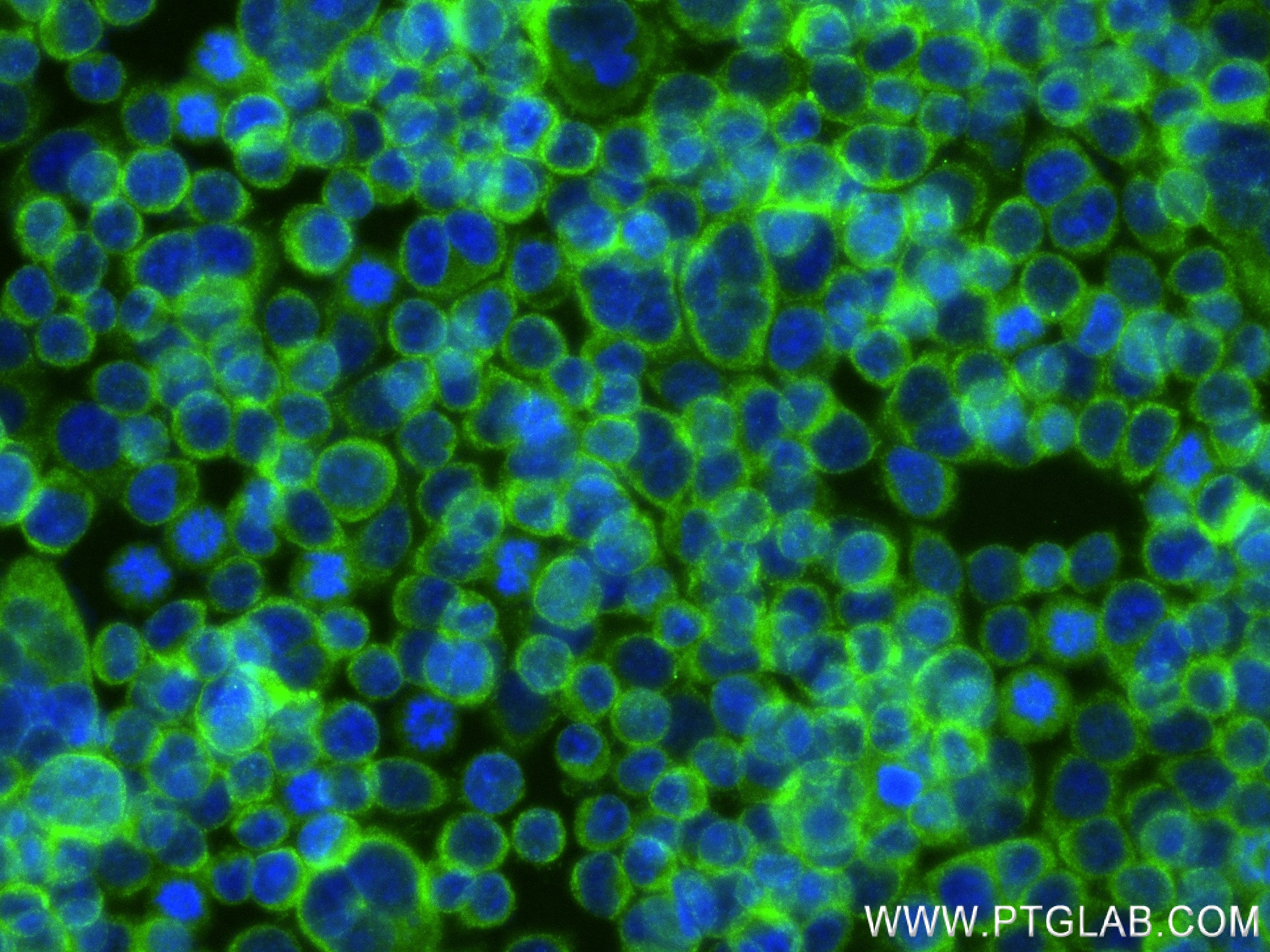 Immunofluorescence (IF) / fluorescent staining of BxPC-3 cells using RNASET2 Recombinant antibody (83650-3-RR)