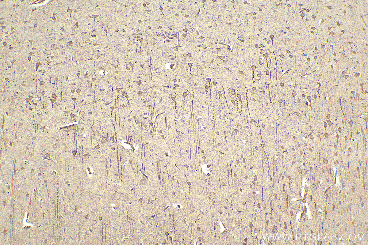 Immunohistochemistry (IHC) staining of rat brain tissue using RND2 Polyclonal antibody (13844-1-AP)