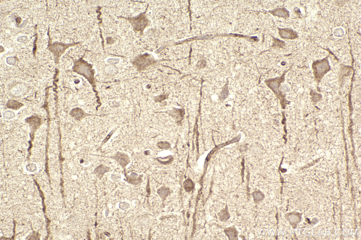 Immunohistochemistry (IHC) staining of rat brain tissue using RND2 Polyclonal antibody (13844-1-AP)