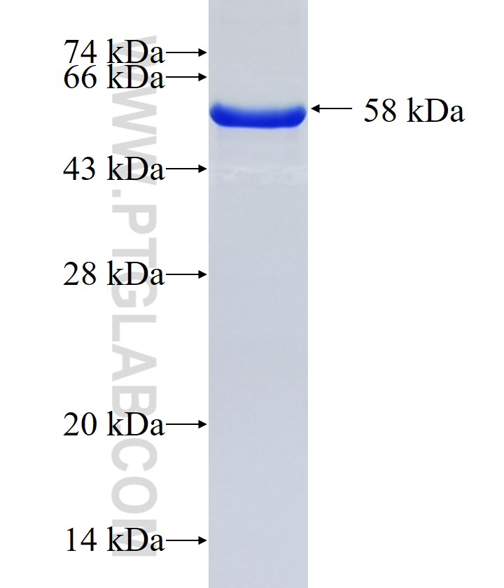 RNF103 fusion protein Ag23304 SDS-PAGE