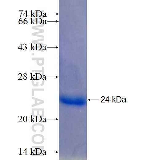 RNF113A fusion protein Ag25324 SDS-PAGE