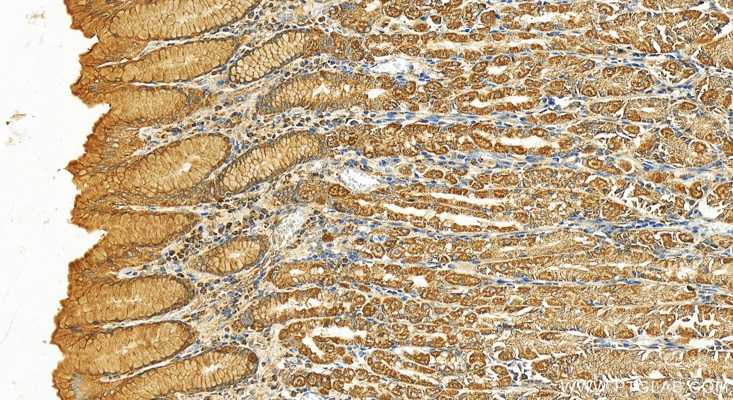 Immunohistochemistry (IHC) staining of human stomach tissue using RNF135 Polyclonal antibody (25061-1-AP)