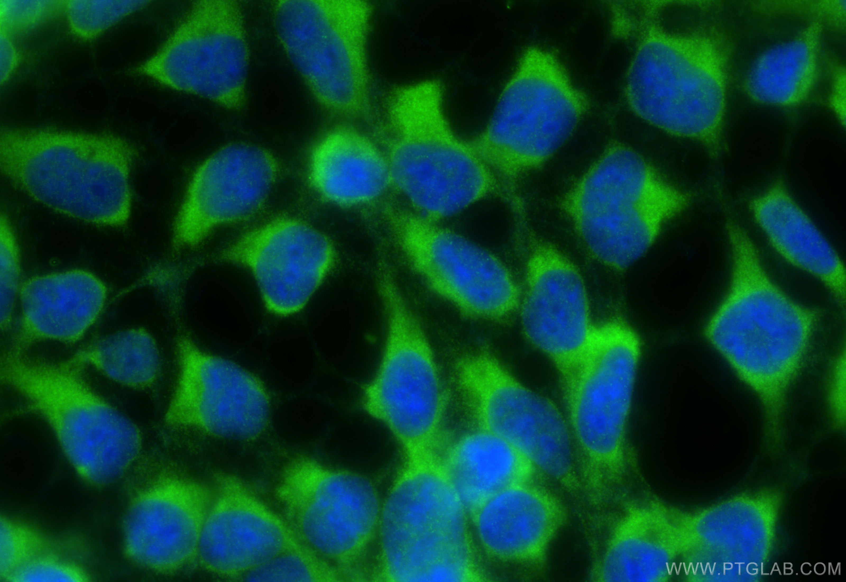 Immunofluorescence (IF) / fluorescent staining of HEK-293 cells using RNF135 Polyclonal antibody (25061-1-AP)