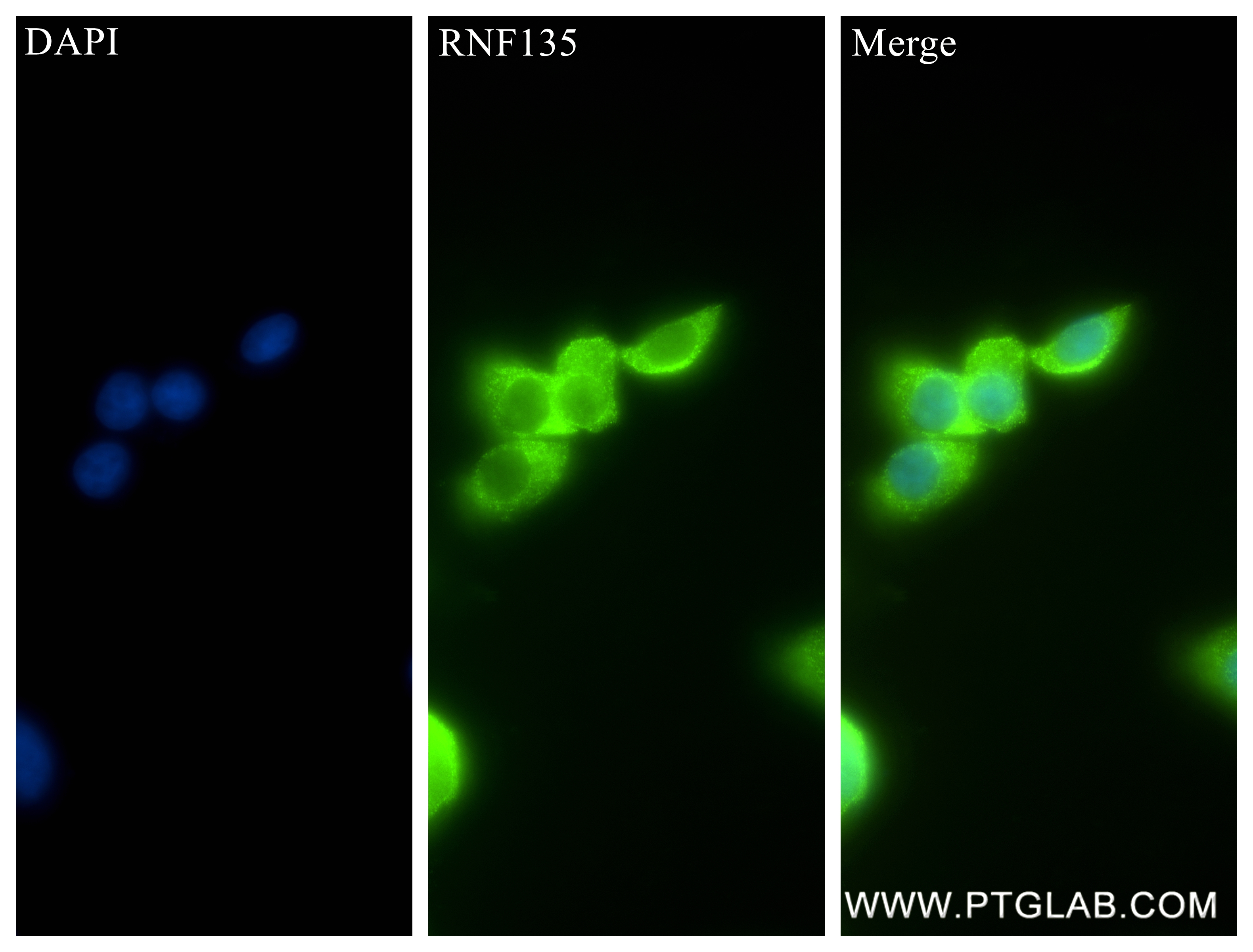 Immunofluorescence (IF) / fluorescent staining of PC-12 cells using RNF135 Recombinant antibody (84984-1-RR)